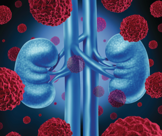 kidney_nephrology